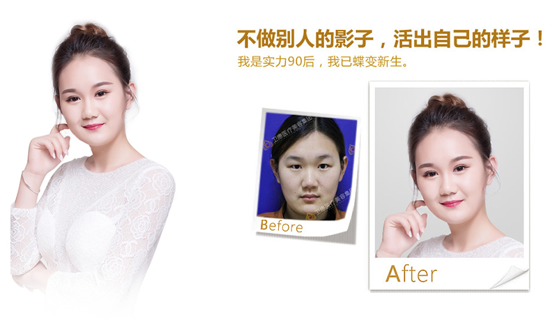 海南纳米脂肪移植